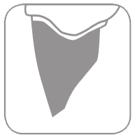 Picto Réduction Occlusale