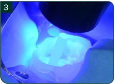 Photopolymérisation