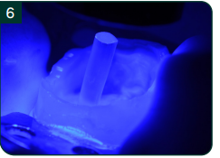 Photopolymérisation