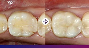 3M_Impenta_CasClinique2