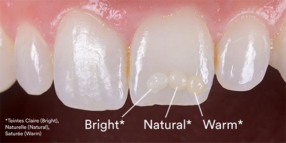 FiltekEasyMatchUniversalRestorative_Teintes1