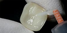 RelyX_Universal_Cas2