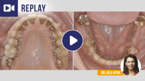 Ortho_Vignette_Replay_1