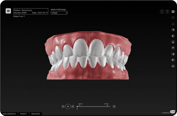 Bruxisme_Mockup